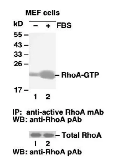 RhoA Activation Assay Kit RhoA Activation Assay Kit