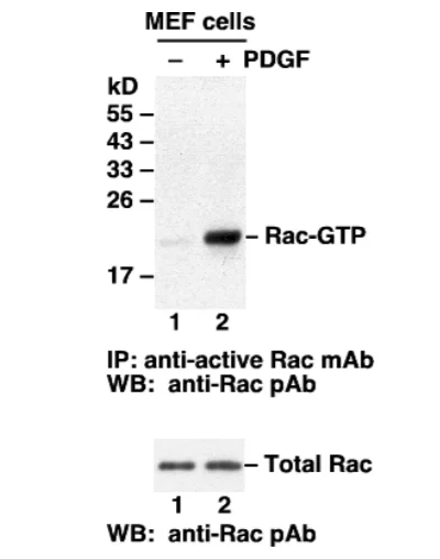 Rac Activation Assay Kit Rac Activation Assay Kit