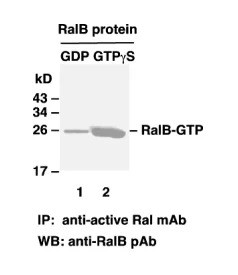 RalB Activation Assay Kit RalB Activation Assay Kit